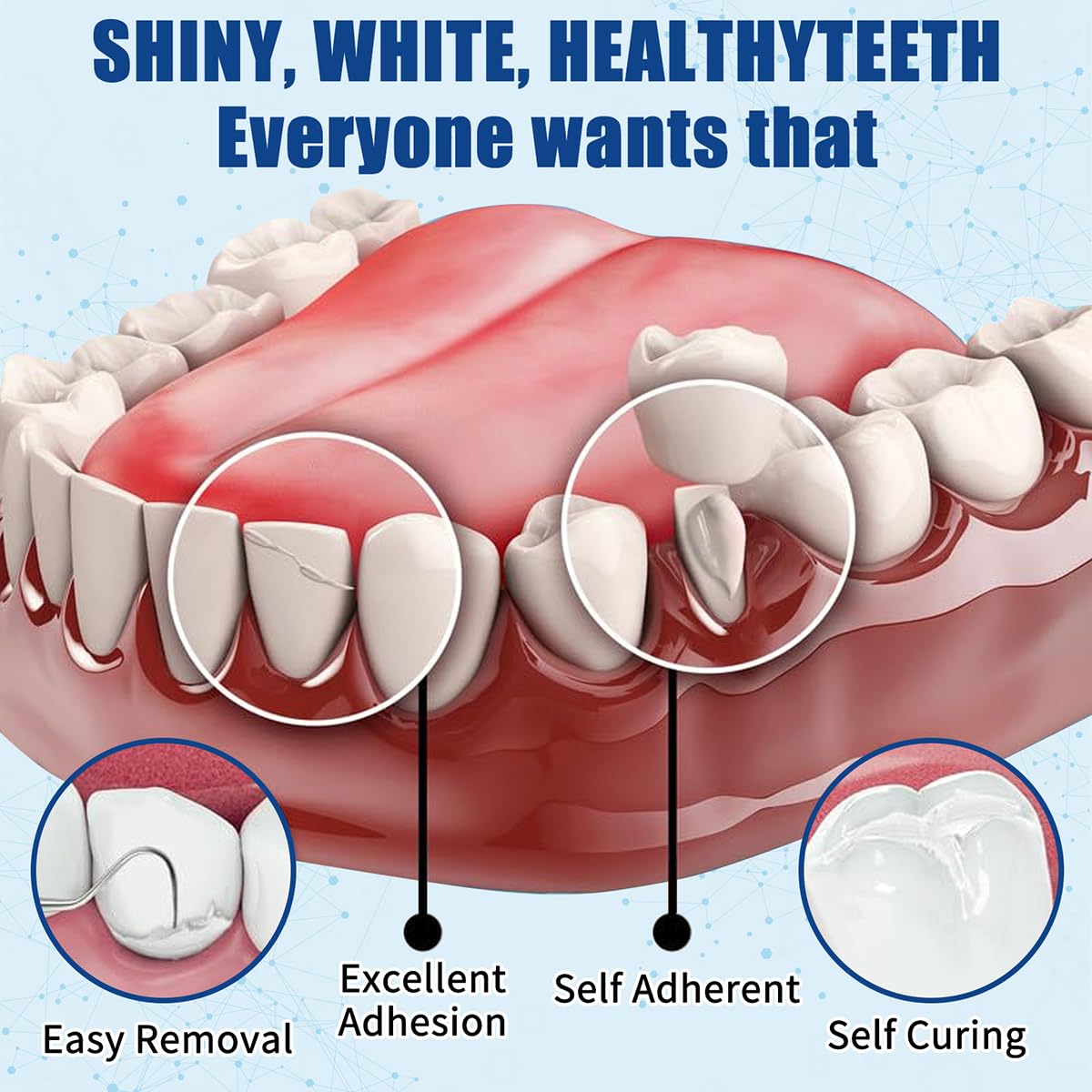 Temporary tooth repair material being prepared in the kit