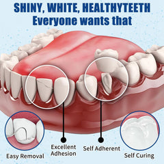 Home-use dental repair materials for chipped or broken teeth