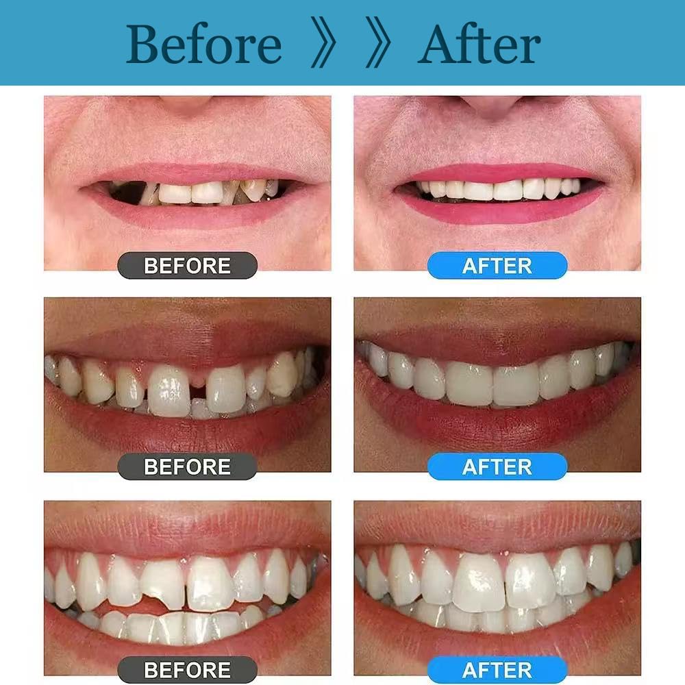 Smiling person showing a confident smile after using the kit