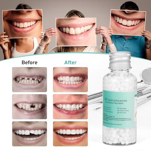 Thermoformed beads used in the kit