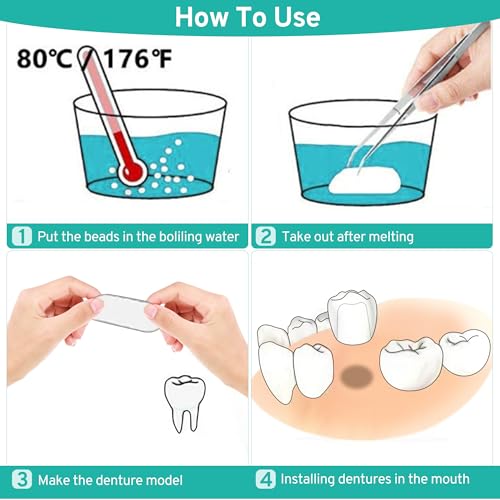 Molded beads shaped to fit a tooth
