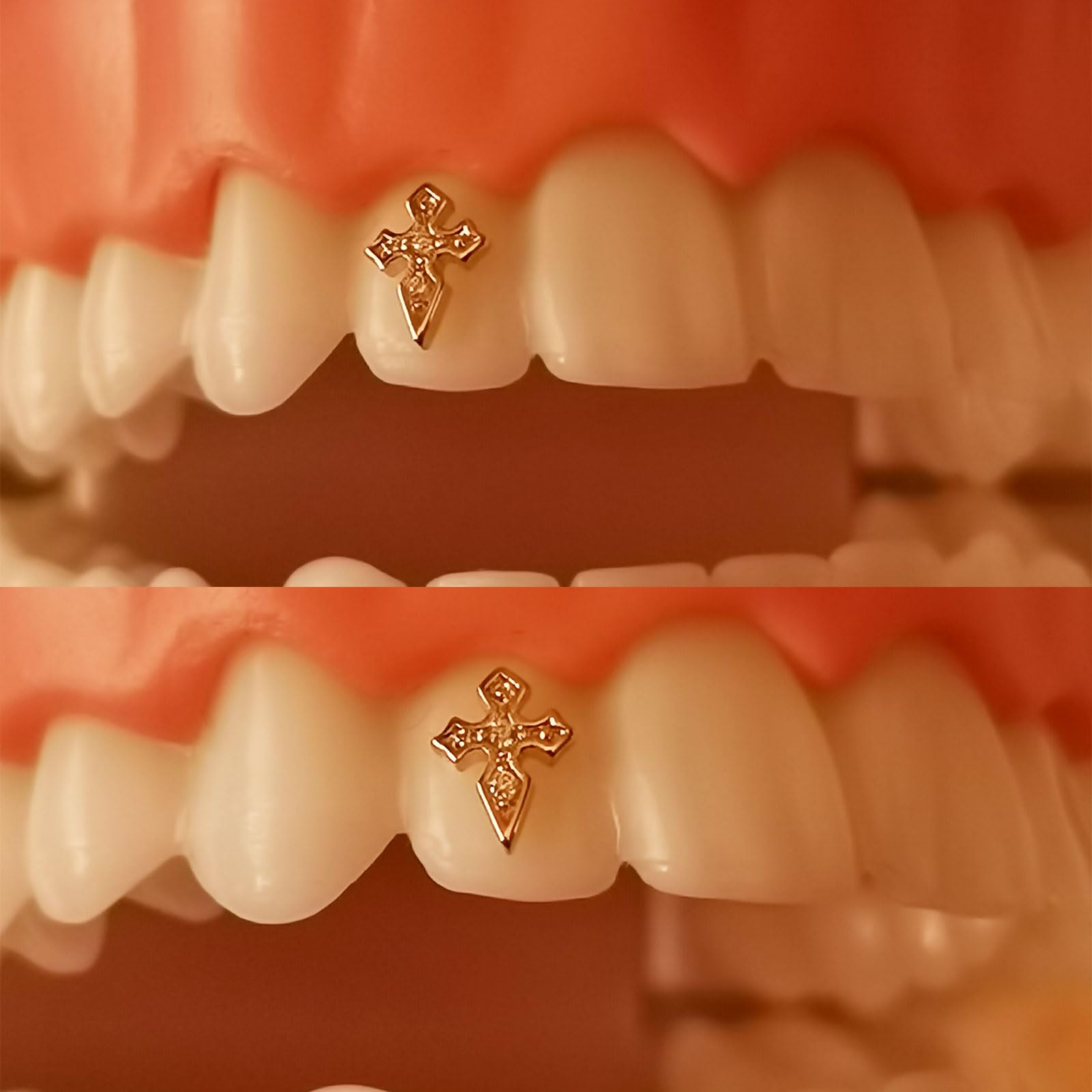 Close-up of high-quality gold tooth gem