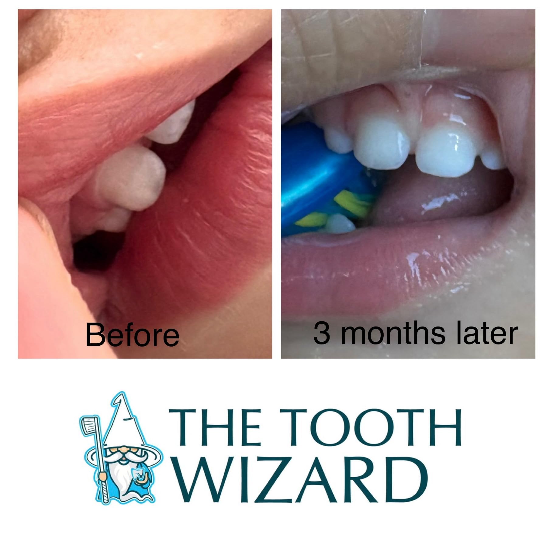 Supports a healthy oral microbiome with balanced pH