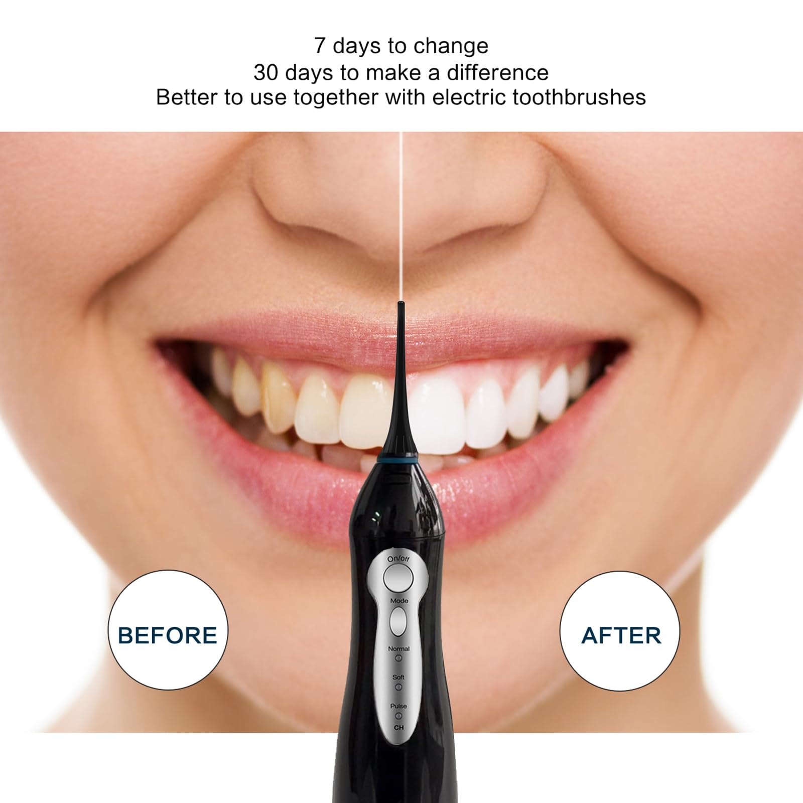 Water flosser used for braces and dental care