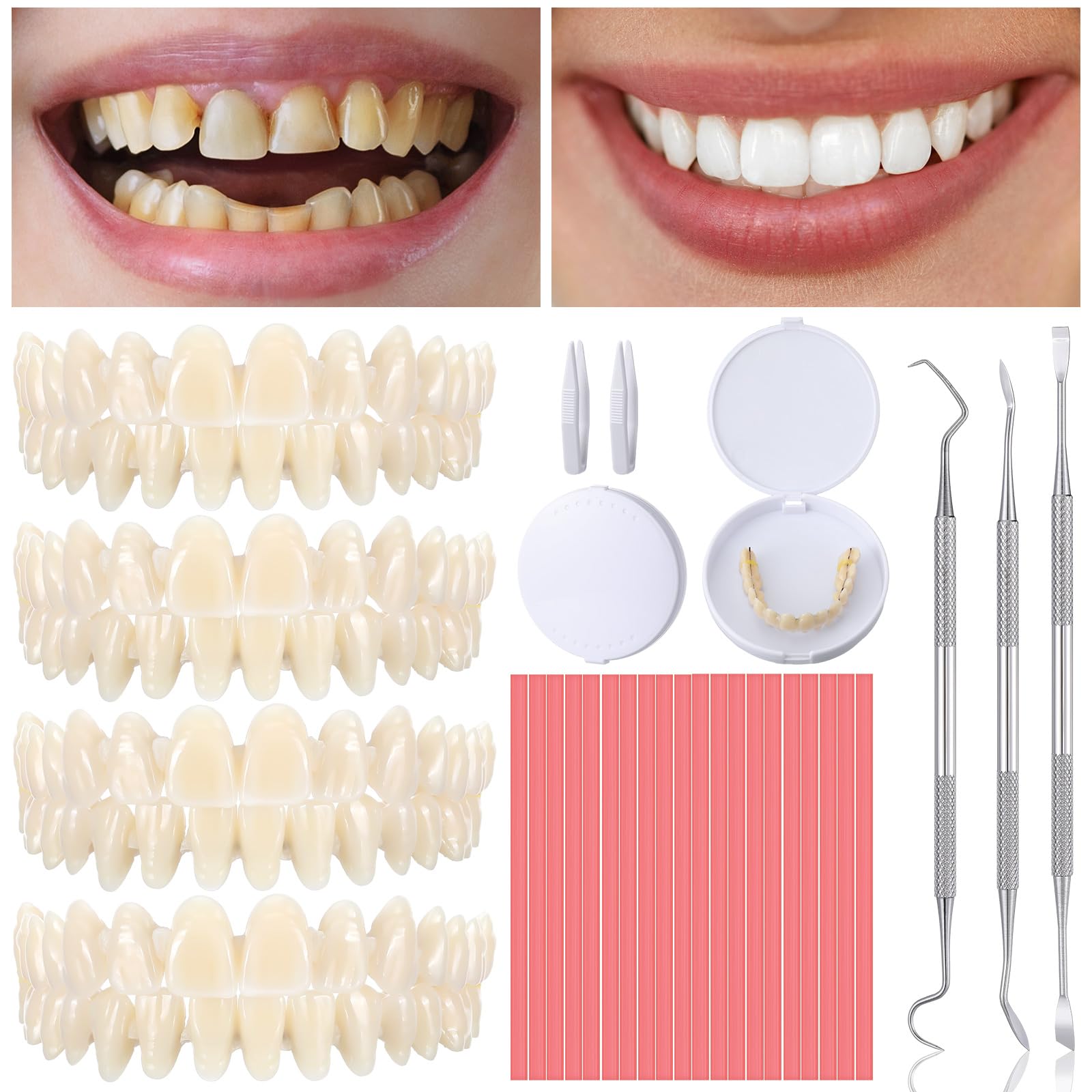 TrelaCo 35 Pcs Dentures DIY Repair Kit with dentures and tools