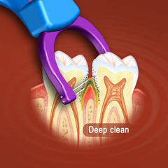 First-time use of T.Smile flosser with refill insert