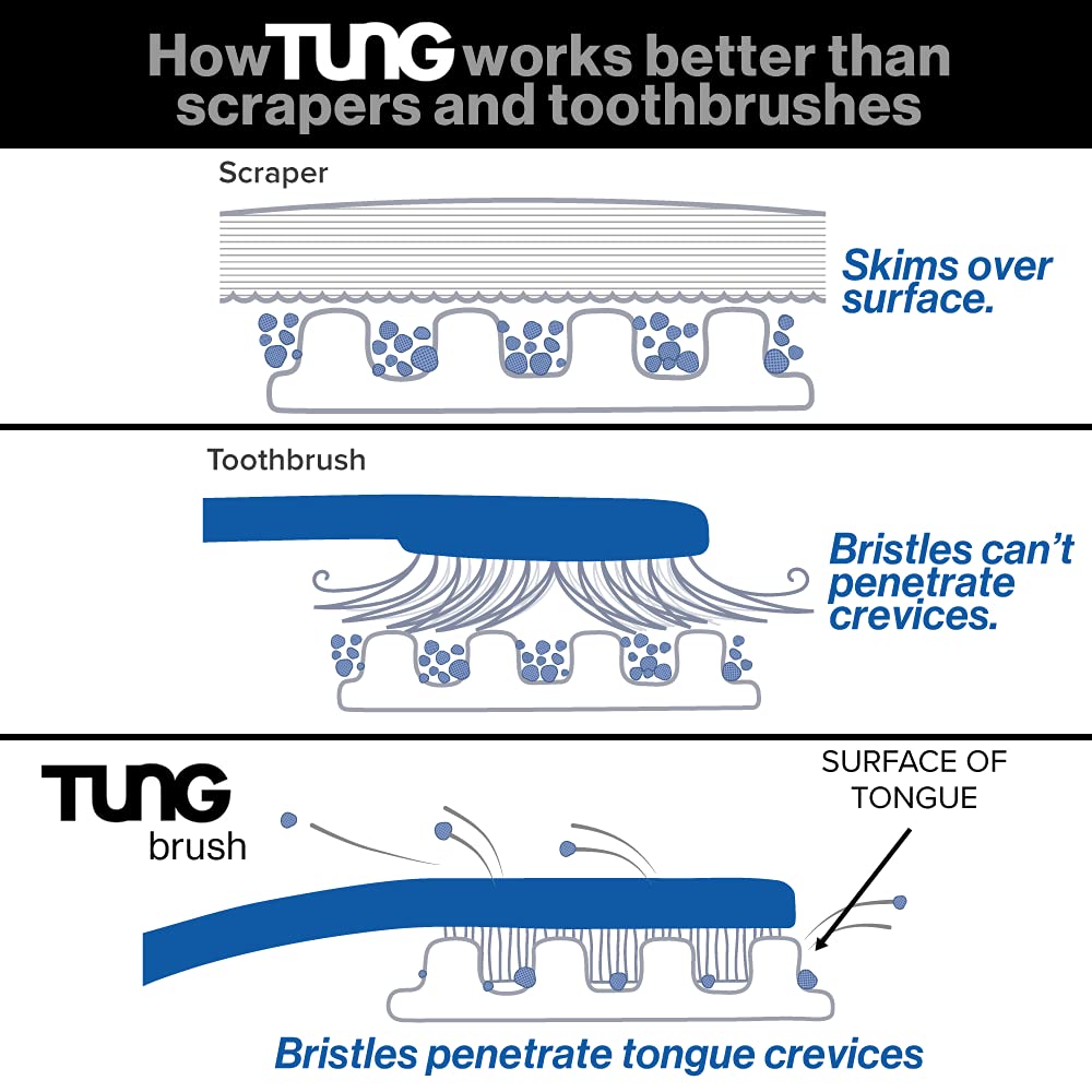 Tung Gel and Brush being used as a mouth sanitizer for halitosis defense