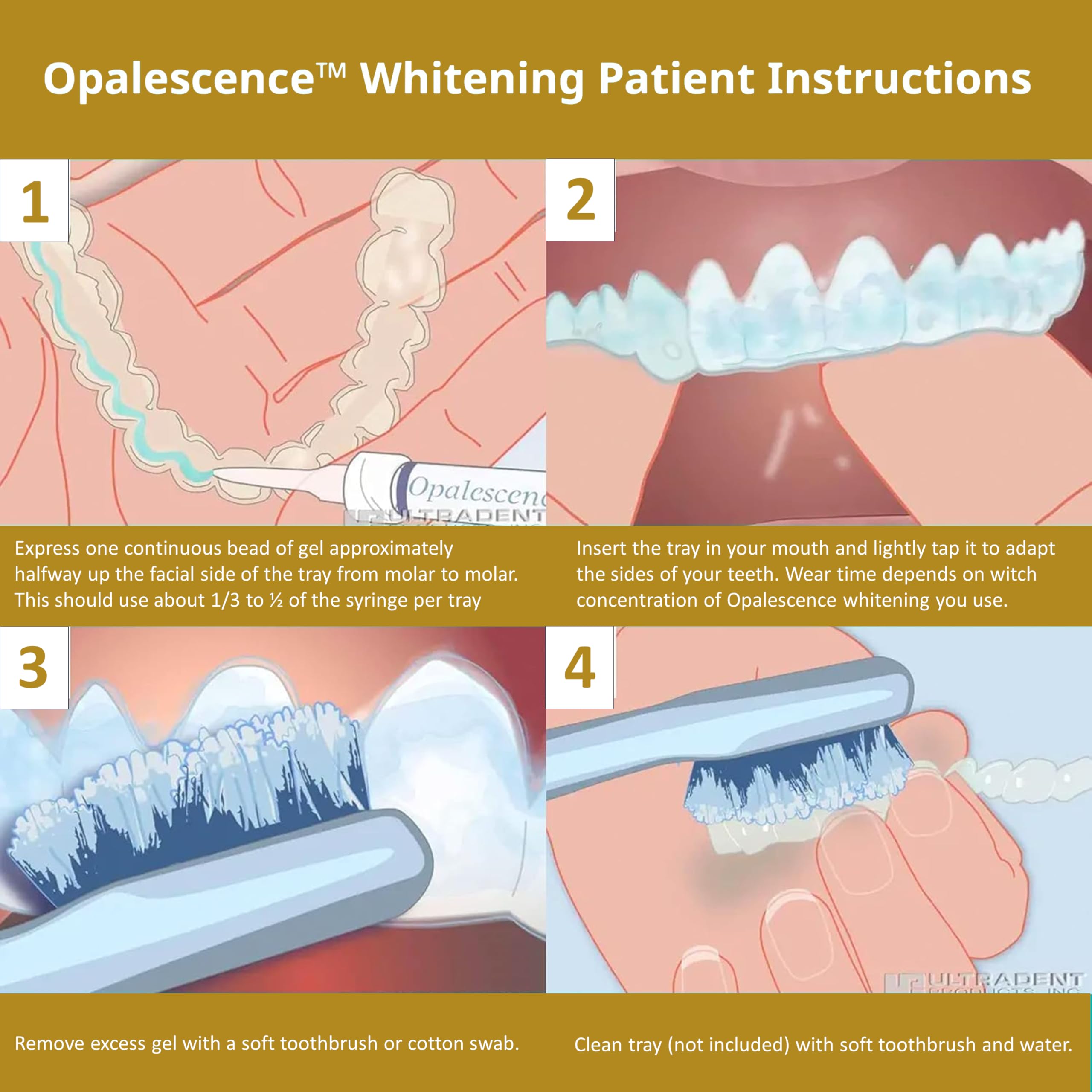 Ultradent Opalescence logo