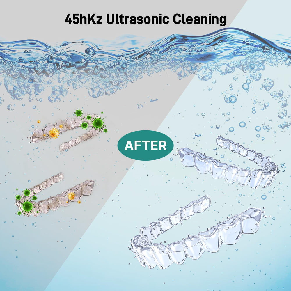 Ultrasonic Retainer Cleaner with integrated UV light