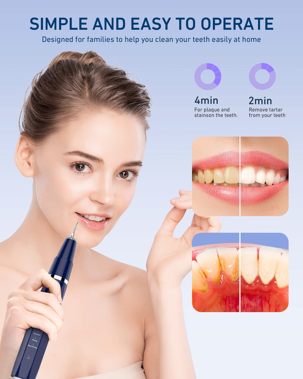USB charging cable for rechargeable teeth cleaning kit