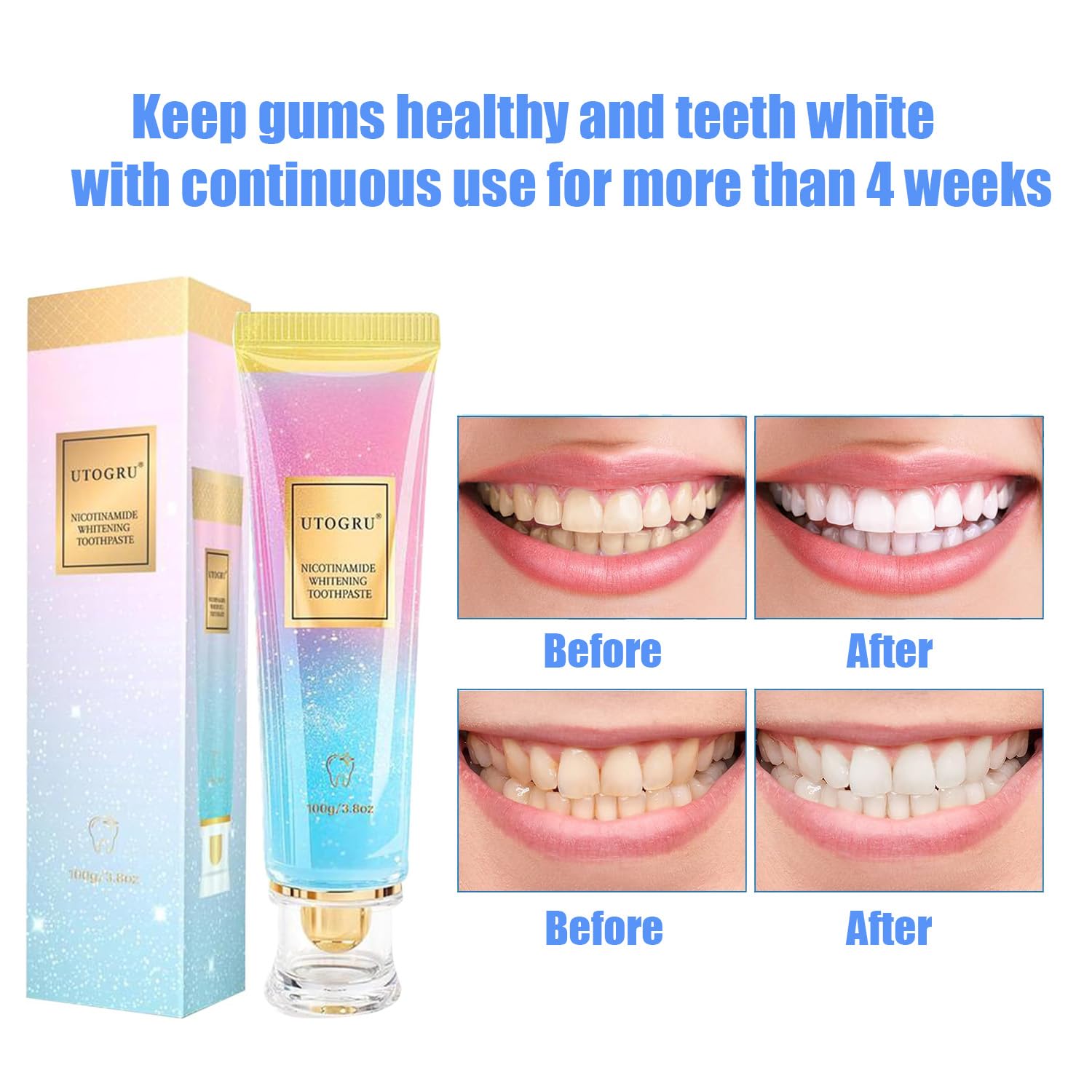 Close-up of Utogru Niacinamide Whitening Toothpaste tube