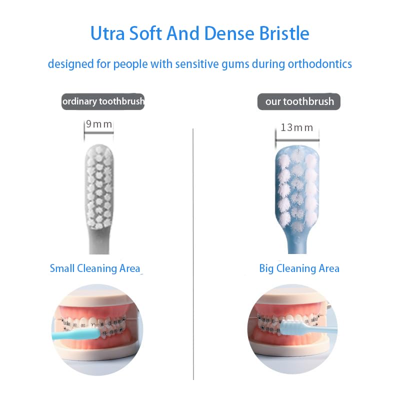 Soft bristles designed for braces wearers and sensitive gums