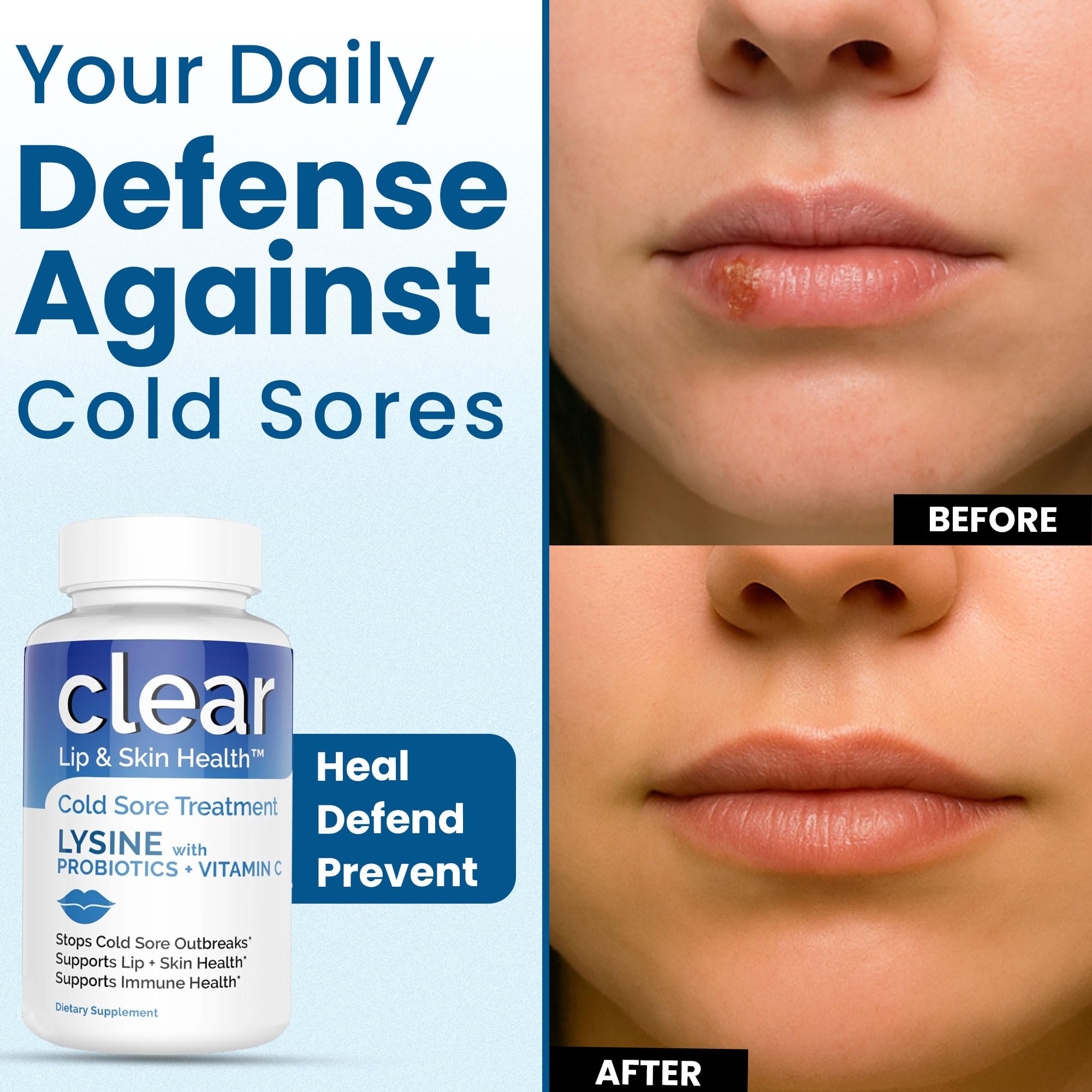 Vegan, non-GMO cold sore supplement packaging