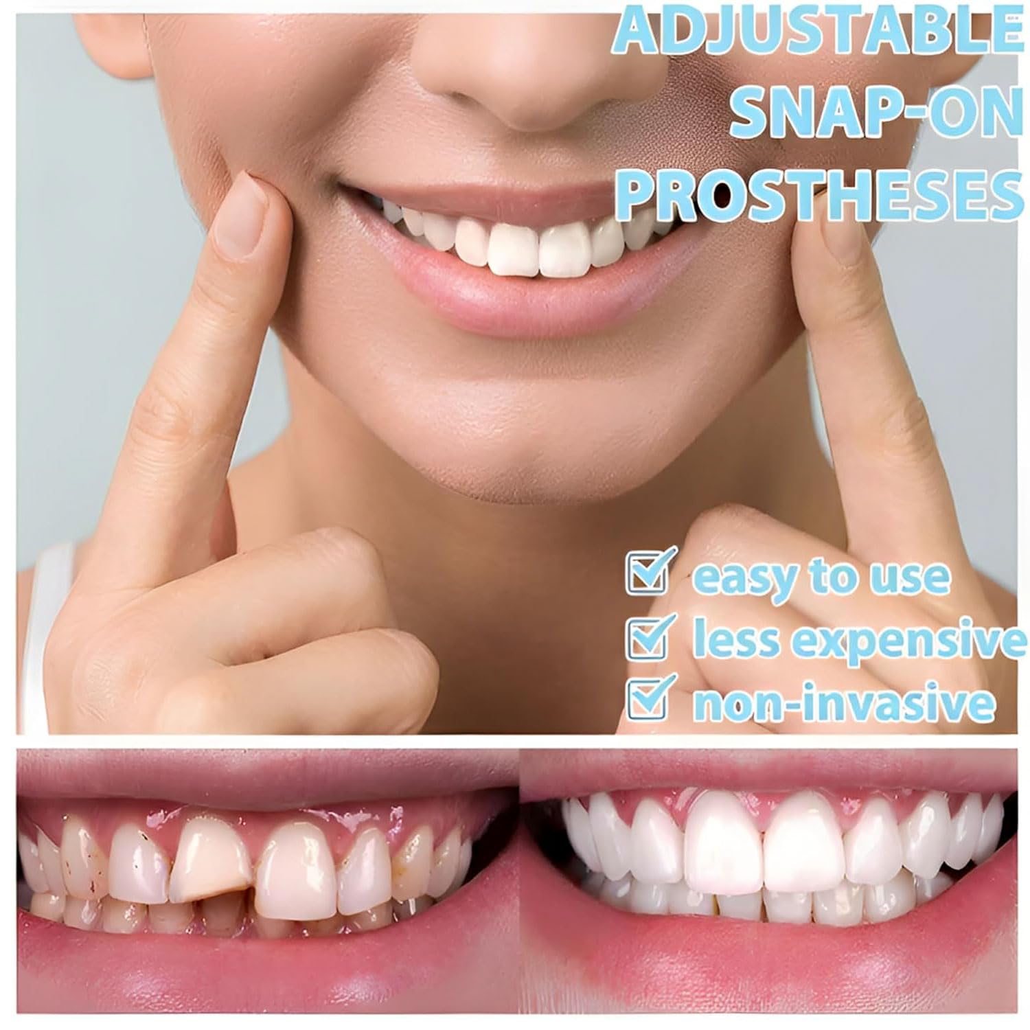 Natural and comfortable veneer kit for a better smile