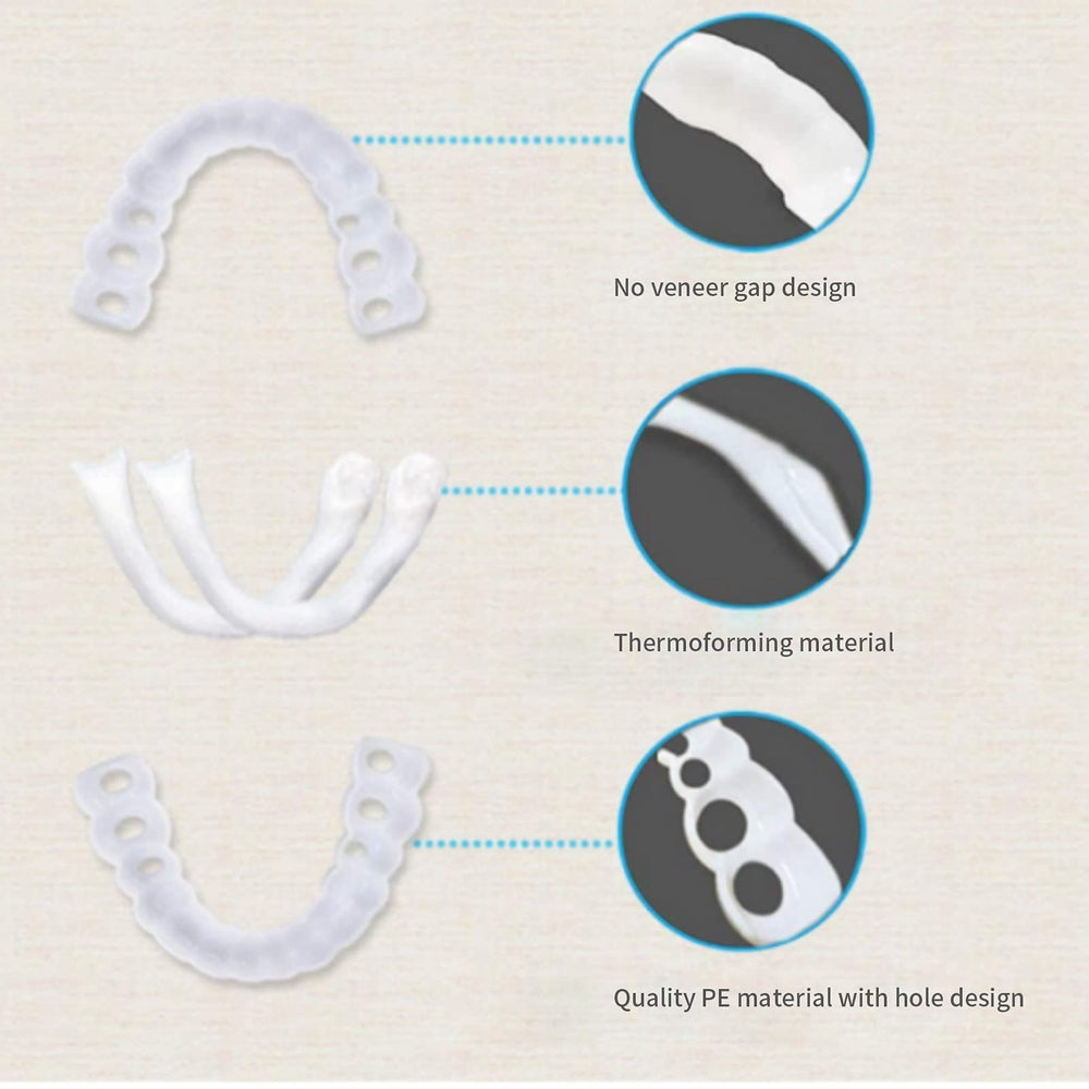 Model wearing veneers demonstrating snap-in use
