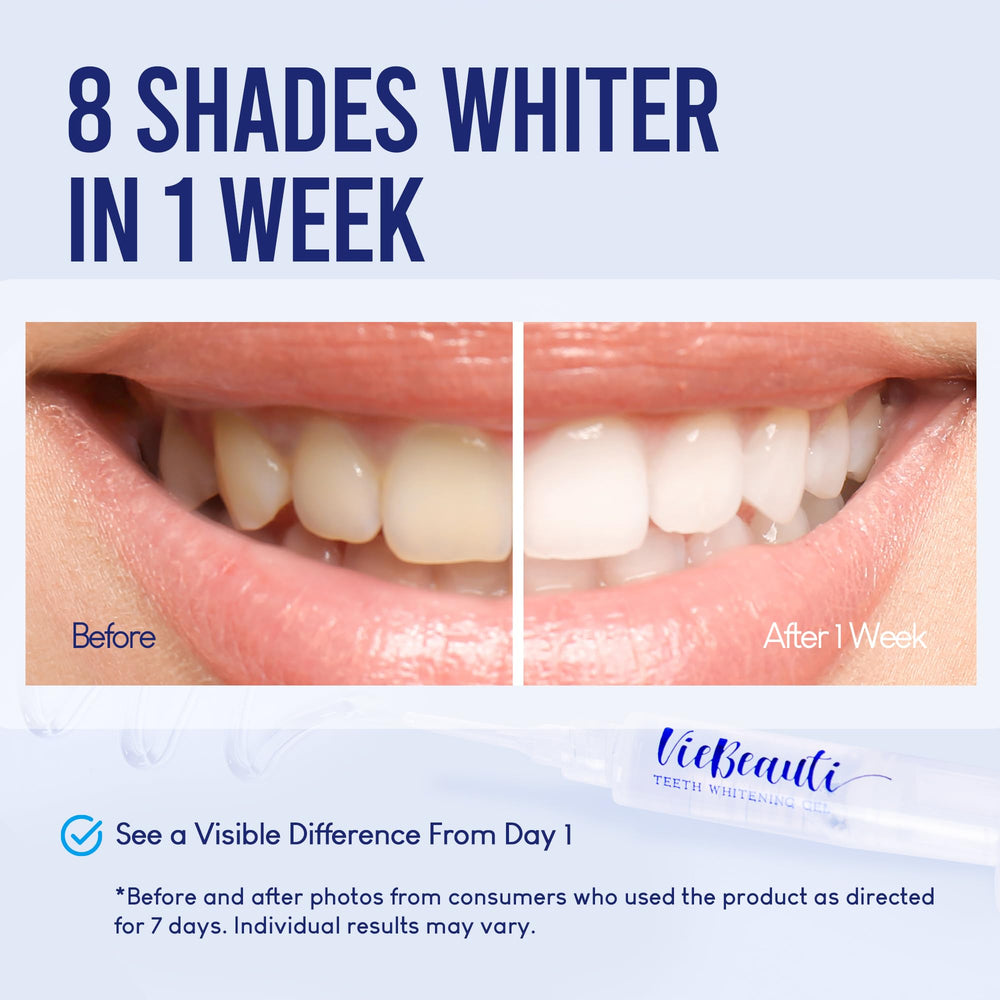Wireless LED accelerator light for at-home whitening