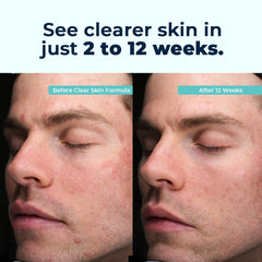 Product shot showing VitaMedica Clear Skin Vitamin Formula label