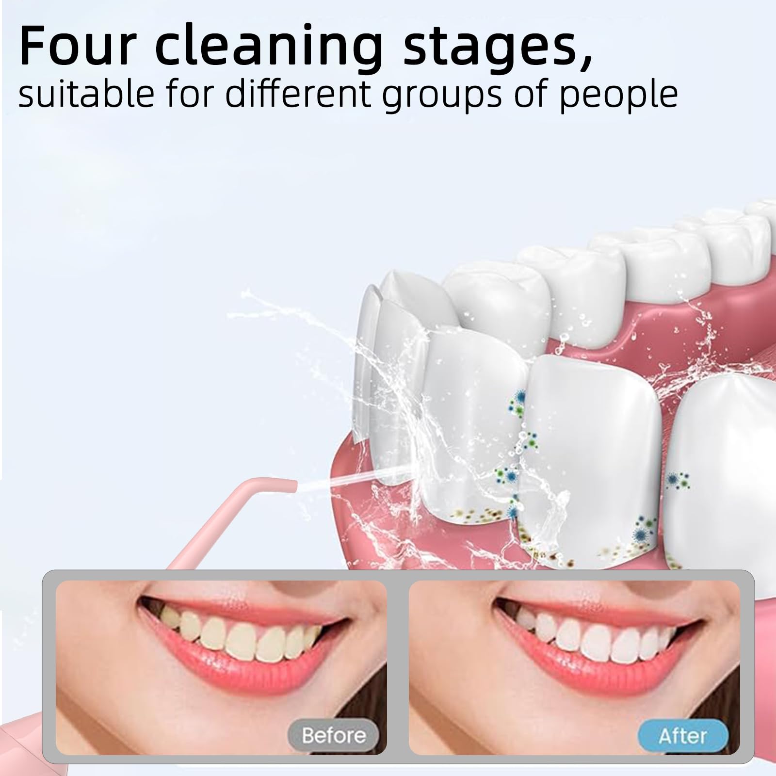 Travel bag included with water flosser