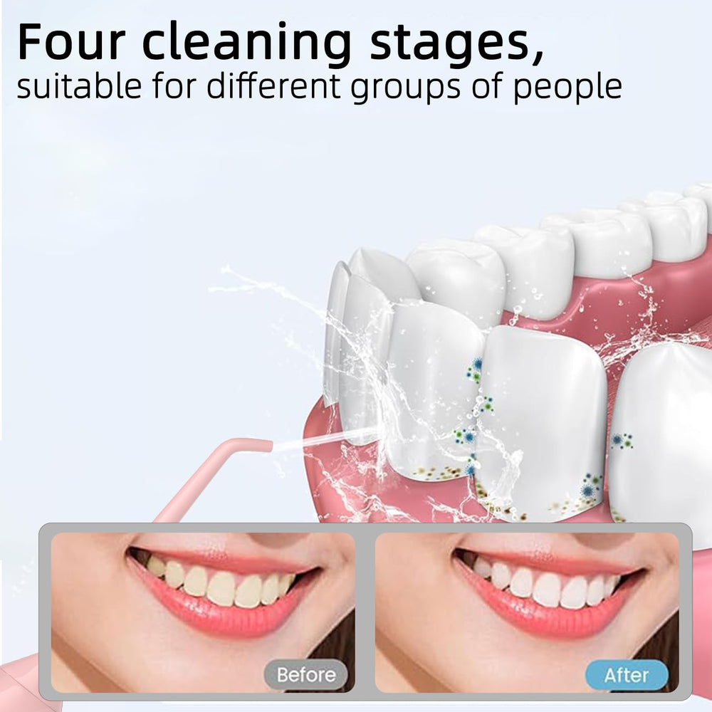 Travel bag included with water flosser