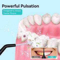 Five interchangeable tips for braces, adults, kids, and tongue cleaning