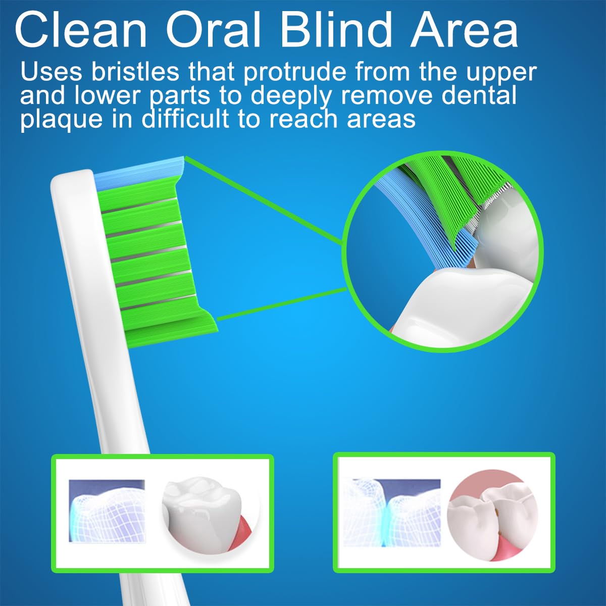Close-up of bristles on Wetqaip toothbrush head for deep cleaning