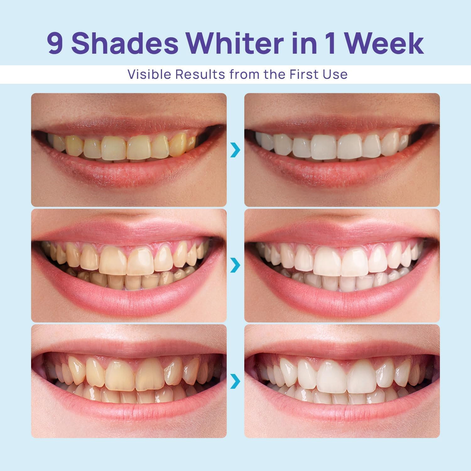 Dual LED whitening light on Whitebite Pro device