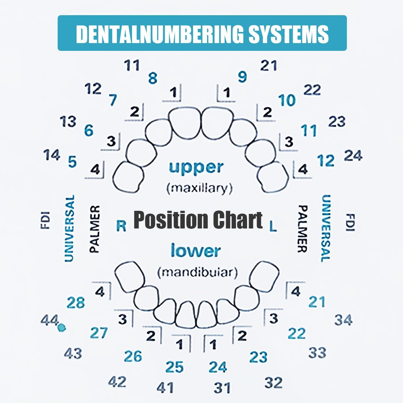 Upper and lower veneer molds with size coding