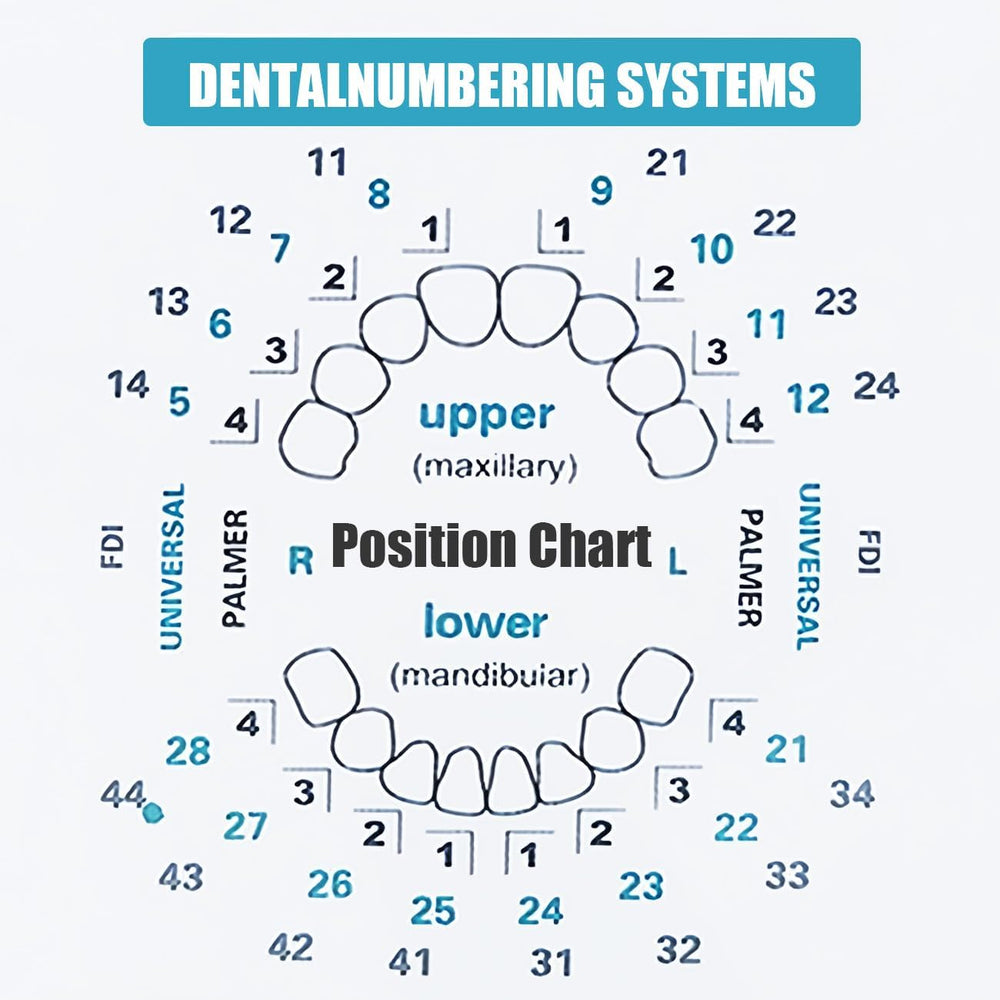 Upper and lower veneer molds with size coding