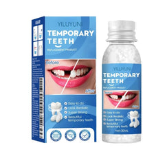 YILUYUNI denture repair beads kit packaging