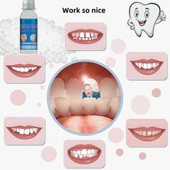 Denture repair beads components laid out