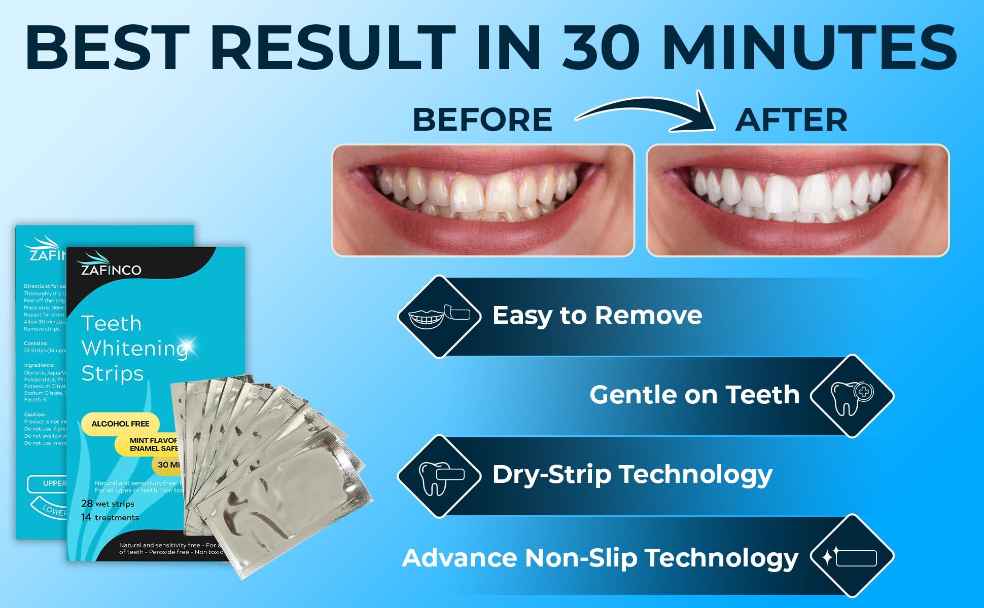 ZAFINCO whitening strips dentist-recommended