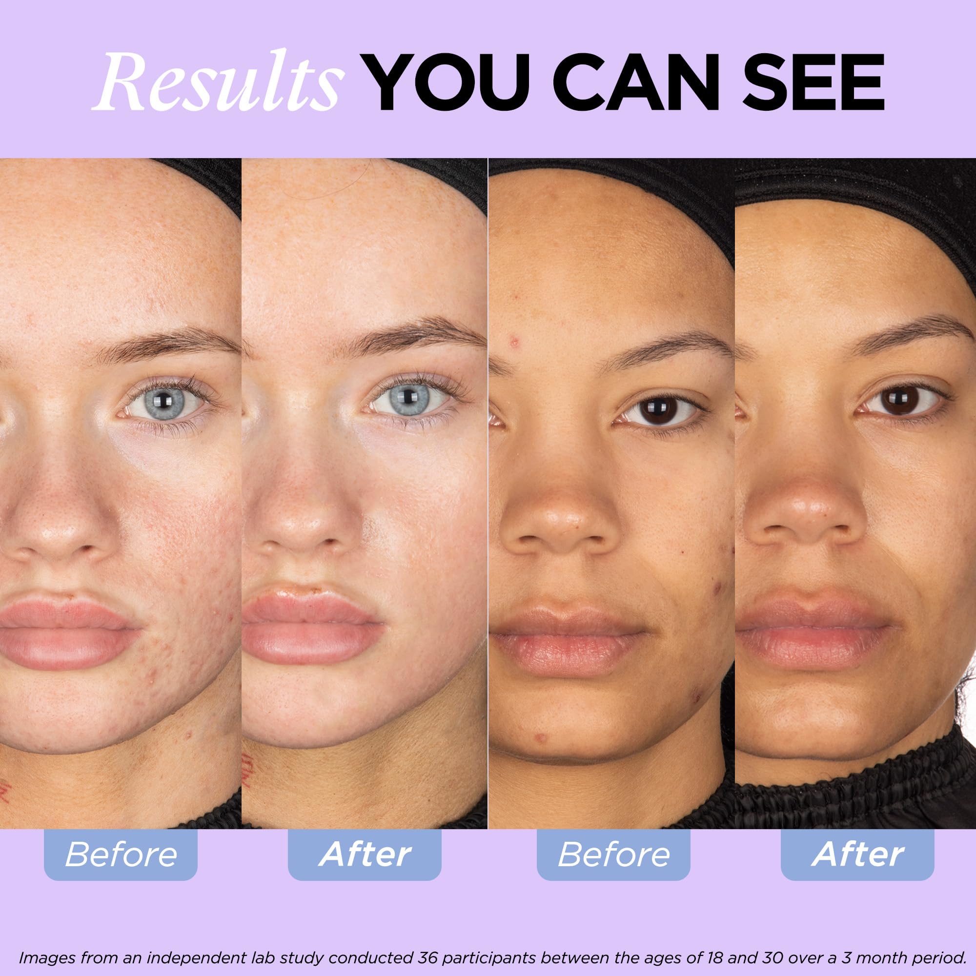 Vitamin C and Zinc benefits for skin health
