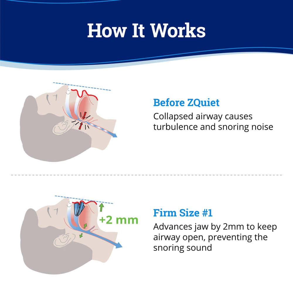 ZQuiet Firm mouthpiece box and instructions